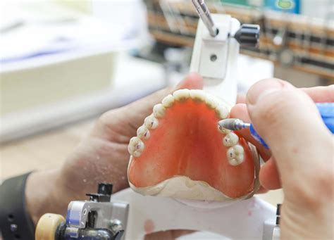 Immediate Dentures - Apple Denture and Implant Solutions