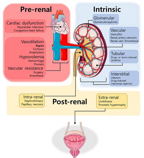 Postrenal Azotemia Video Anatomy Definition Osmosis 58 Off