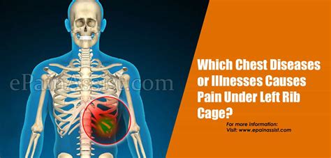 Which Chest Diseases Or Illnesses Causes Pain Under Left Rib Cage
