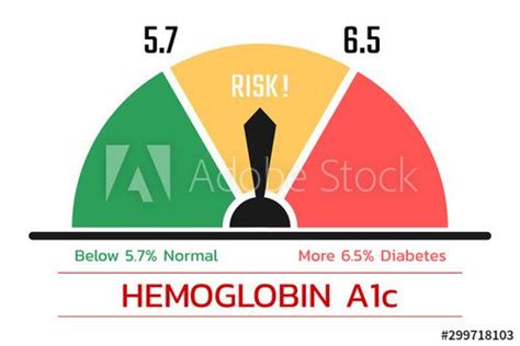 Hemoglobin A1c Test Score Health Concept Vector