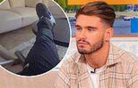 Love Islands Jacques Oneill Rushed To Hospital After Fracturing His