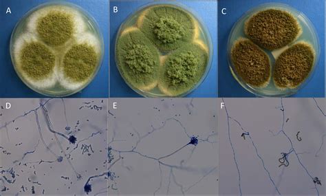 The conidial spores are produced from the phialides on the conidiophore vesicles. ASPERGILLUS TAMARII PDF