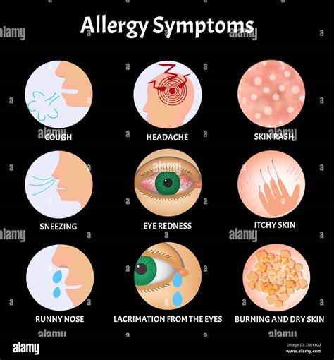 Symptoms Of Allergies Skin Rash Allergic Skin Itching Tearing From