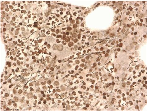 Erythrocytes Basicmedical Key