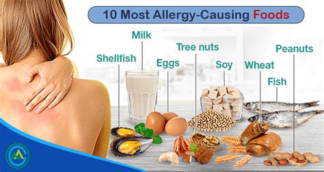 What Foods Cause Food Allergies Know Your Allergy