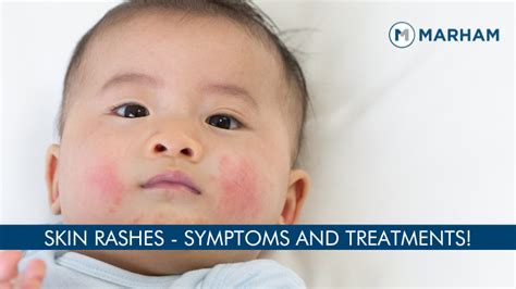 5 Common Skin Rash Types And Their Symptoms Marham