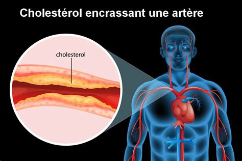 Liste de 20 comment avoir du bon cholestérol