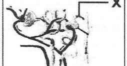 Check spelling or type a new query. Kunci Jawaban Perhatikan gambar nefron ginjal berikut ...