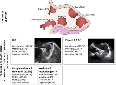 Management And Outcomes Of Patients With Left Atrial Appendage Thrombus