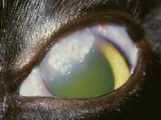 Most cases are associated with allergy. Eosinophilic Keratitis / Conjunctivitis