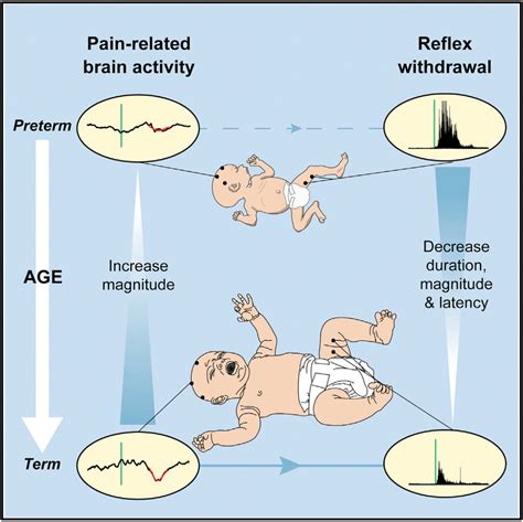Research Sheds New Light On How Babies Feel And Respond To Pain