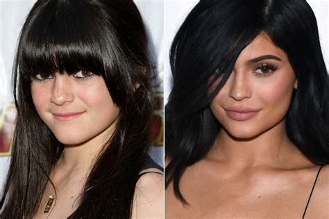 Kylie Kardashian Before And After