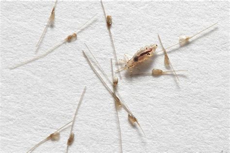 Lice Clinics of America » Urgent Care for Lice Removal