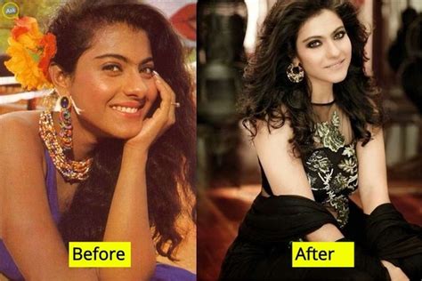 Then And Now Looks Of 10 Bollywood Actresses Who Have Undergone Plastic Surgery