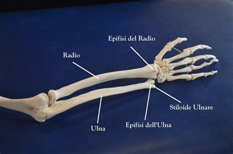 Frattura dell'ulna nel polso, sintomi, cura e tempi di ...