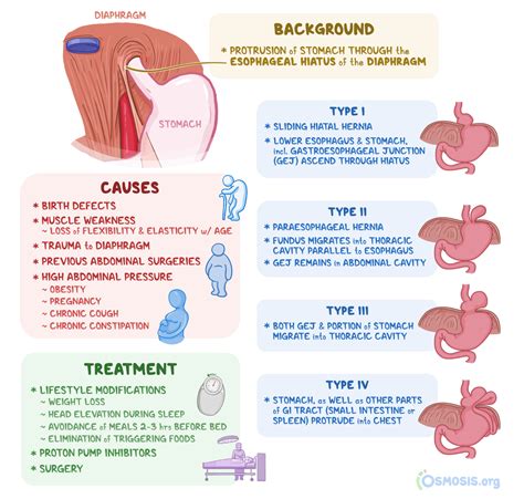 Hiatal Hernia What Is It Diagnosis Treatment And More Osmosis