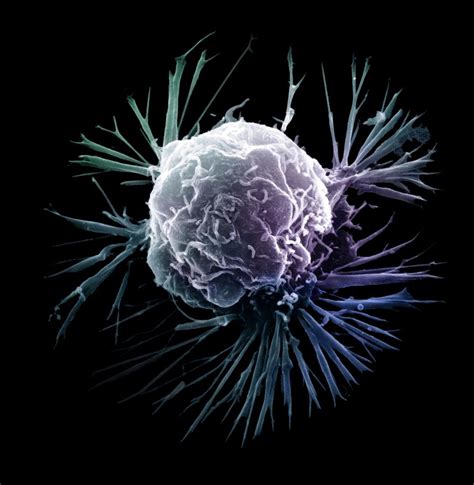 Breast Cancer Cell Photograph By Ami Imagesscience Photo Library