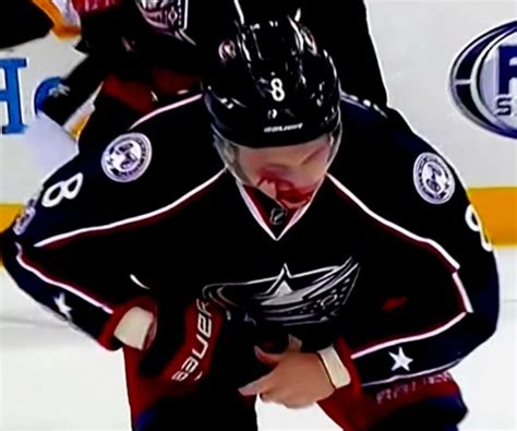 Werenski's injury was caused when he collided with new york islanders forward anders lee near the columbus goal in the #cbj zach werenski heads to the room after this collision with anders lee. Zach Werenski Keeps Playing Despite Bloody Face