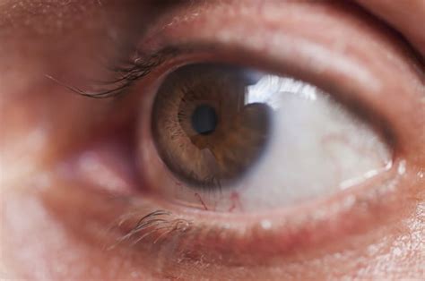 It can occur at if glaucoma is recognized early, vision loss can be slowed or prevented. Glaucoma: Causes, Treatment and Awareness | | Delhi Eye Center