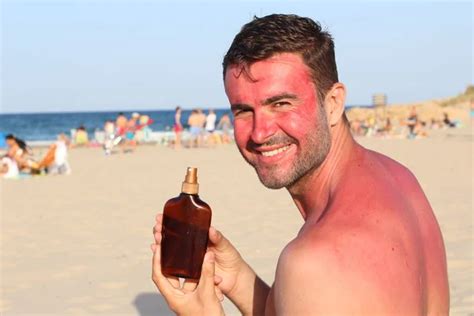 Man Getting Sunburned Beach Stock Photo By ©albejor2002