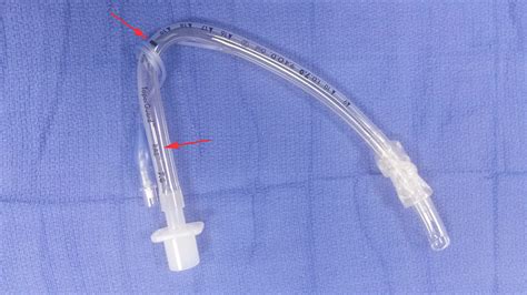 RAE Tubes Anesthesia Airway Management AAM