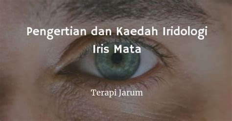 20 746 просмотров 20 тыс. Pengertian dan Kaedah Iridologi Iris Mata - Terapi Jarum