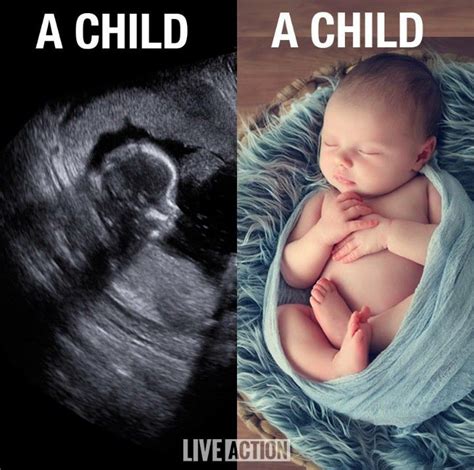 Is An Unborn Baby A Child Pro Life Baby Life Unborn Baby