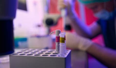 Para Que Serve O Coagulograma