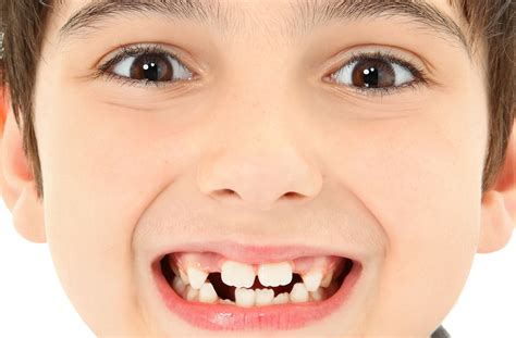 Ensuring Your Child Develops Healthy Teeth For Life