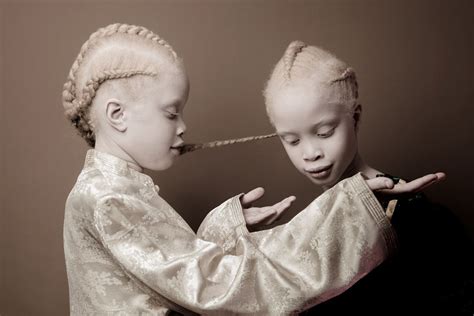 Albino Twins From Brazil Are Challenging The Fashion Industry With