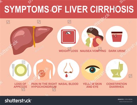 Liver Cirrhosis Symptom Useful Advices Infographic Vector De Stock
