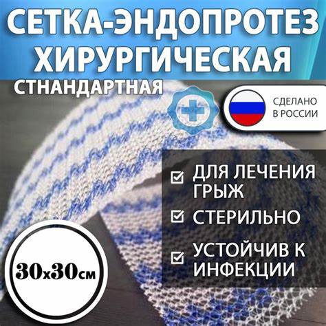 Диета для грыжи диафрагмы Сетка хирургическая для грыжи Эндопротез стандартный ЭСФИЛ 30х30см Сетка хирургическая для грыжи Эндопротез стандартный ЭСФИЛ 30х30см Диета для грыжи диафрагмы