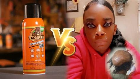 Gorilla Glue Girl Hospitalized After Using Super Glue To Spray On Her