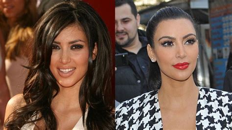 Kim Kardashian Before And After Inside Her Secret Surgery Transformation