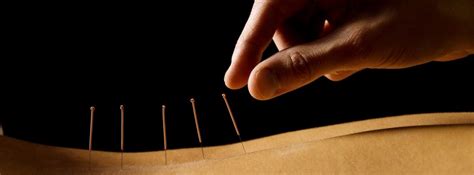 Woman Getting An Acupuncture Treatment In A Spa Escuela Li Ping De Acupuntura Y Mtc