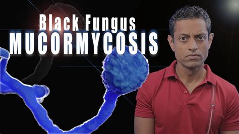 Mucormycosis Black Fungus Symptoms Of Mucormycosis Youtube