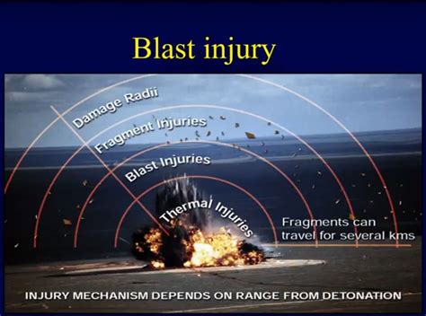 Orthopaedic Blast Injuries Blast Wave Mechanics