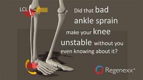 Ankle Sprain Knee Pain