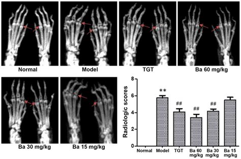 Baicalin Alleviates Collagen‑induced Arthritis And Suppresses Tlr2