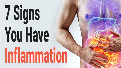 7 Signs You Have Inflammation Inflammation Autoimmune Skin Burning Body