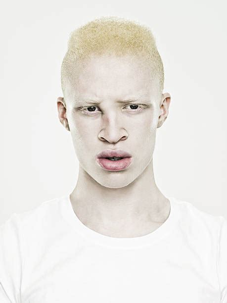 2100 African Albino Stock Photos Pictures And Royalty Free Images Istock