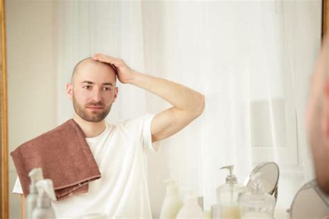 9 Head Shave Benefits 7 Disadvantages Of Going Bald