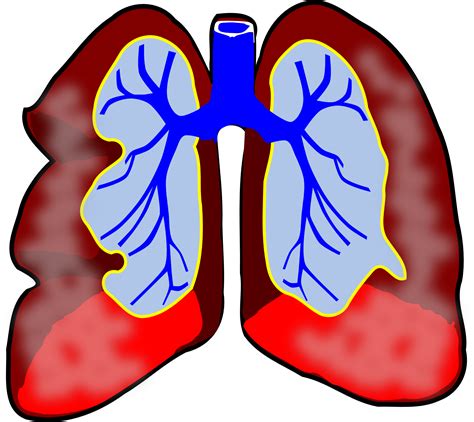 Lungs Clipart Lung Disease Lungs Lung Disease Transparent Free For