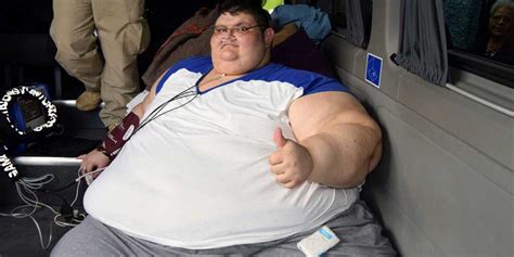 Worlds Heaviest Man Has Surgery To Halve Weight Photo