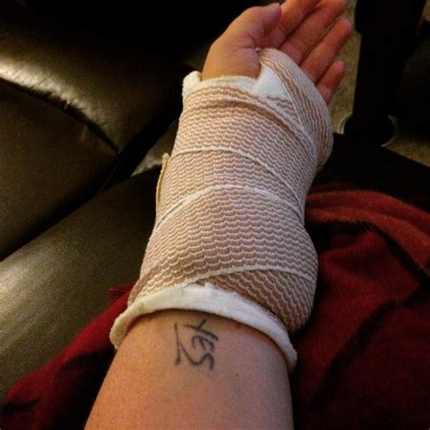 Wrist cyst surgery - Extra Black Olives