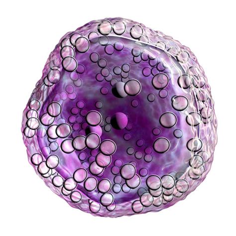 Lymphoma is a broad term for cancer that begins in cells of the lymph system. Lymphoma Cancer Cell Stock Photos, Pictures & Royalty-Free ...