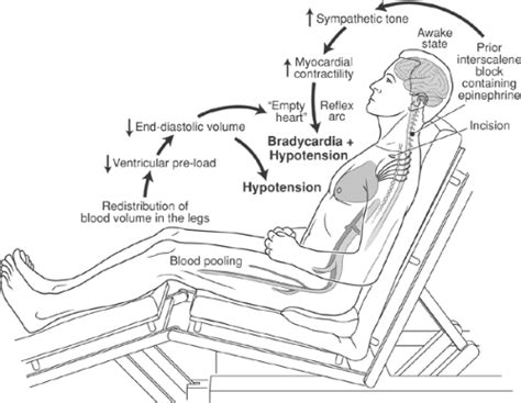 A rectal examination determines the pain of the douglas space due to the accumulation of peritoneal exudate. The Upper Extremity: Somatic Block | Anesthesia Key