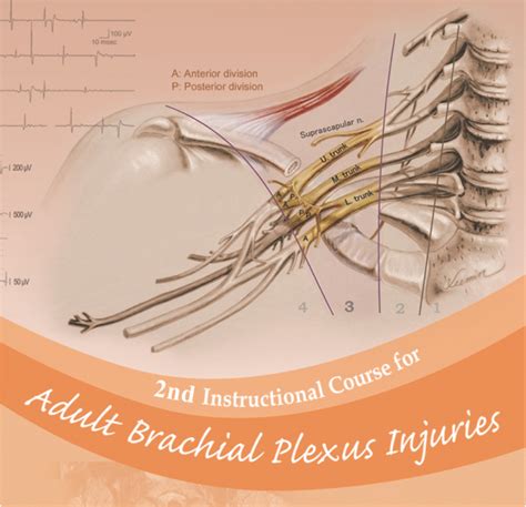 2017 2nd Instructional Course For Adult Brachial Plexus Injuries Taoyüan