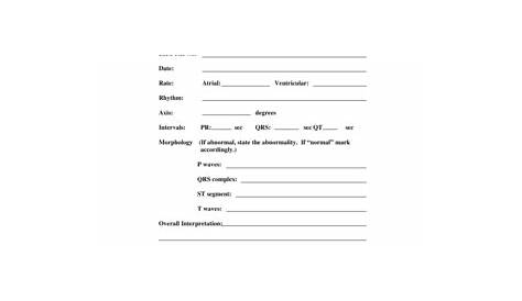 Ekg Interpretation Cheat Sheet Form - Fill Out and Sign Printable PDF
