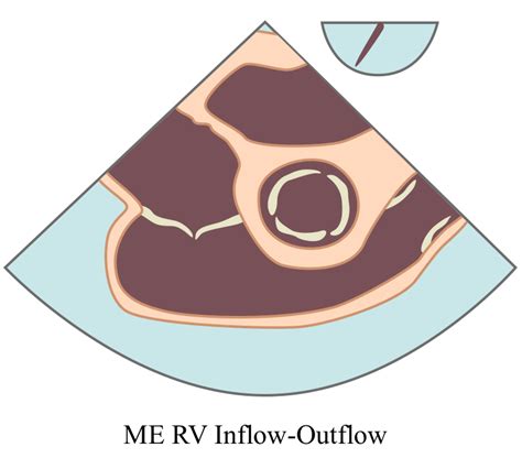 Mid Esophageal Rv Inflow Outflow View